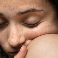 How do I treat Sunspots?